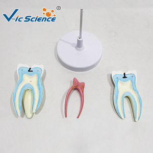 Modèle de molaires modulaire en trois parties, représentant la structure d'un dentier cariote, utilisé comme outil pédagogique et de formation en milieu scolaire - Product Image 1
