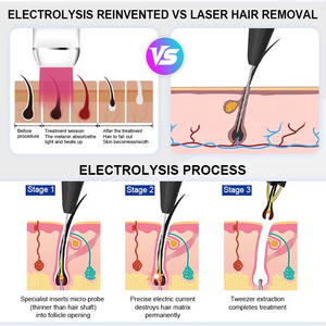 Máquina de Electrólisis de Microcorriente ABS de Escritorio 13.26MHZ para Depilación Permanente, Termólisis y Eliminación de Vello Rojo y Blanco - Product Image 5