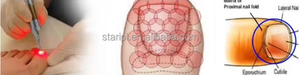 Gran oferta, eliminación de hongos en uñas con láser de 980nm, onicomicosis, láser personalizado, elimina las infecciones fúngicas para uñas hermosas y saludables - Product Image 5