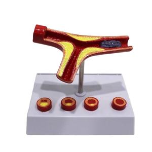 Modelo de Aterosclerosis y Trombosis de Arterias Cardiovasculares, Modelo de Obstrucción Patológica de Vasos Sanguíneos - Product Image 1