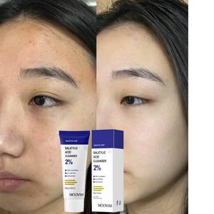 Hot-Bán 80G Tự Nhiên Da Mặt Sữa Rửa Mặt, Làm Sạch Sâu, Kiểm Soát Dầu, Tẩy Tế Bào Chết Salicylic Axit Sữa Rửa Mặt - Product Image 1