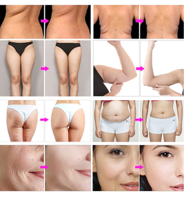 Rodillo de Masaje Portátil 2 en 1 5D con Terapia de Vacío y Bola Interna para Eliminar la Celulitis y Drenaje Linfático / Rodillo Manual - Product Image 6