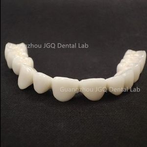 พอร์ซเลนหลอมรวมกับฟันปลอมโลหะ (โลหะผสมโครเมี่ยมโคบอลต์) - Product Image 1