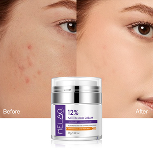 <span class=keywords><strong>Crème</strong></span> de Nuit <span class=keywords><strong>Anti</strong></span>-Acné et <span class=keywords><strong>Anti</strong></span>-Imperfections à Marque Blanche, Éclaircissante, <span class=keywords><strong>Hydratante</strong></span>, <span class=keywords><strong>Anti</strong></span>-Taches Brunes, au Niacinamide - Product Image 5