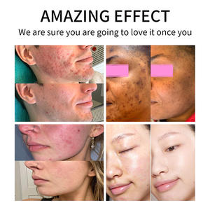 ODM Private Label пребиотическая глубоко питательная осветляющая увлажняющая Антивозрастная пробиотическая Сыворотка для лица против акне для тусклой кожи - Product Image 4