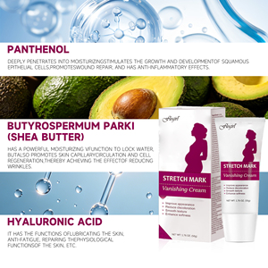 Crème Corporelle <span class=keywords><strong>Anti</strong></span>-Vergetures au Beurre de Karité, Panthénol et Acide Hyaluronique pour <span class=keywords><strong>Grossesse</strong></span> – Vente en Gros - Product Image 3