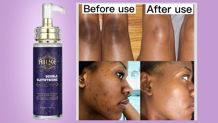 how much l glutathione for shingles Zooki Liposomal Glutathione Capsules 30 Servings
