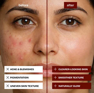 Aceite facial herbal Kumkumadi para una piel radiante, cuidado de la pigmentación, reparación de manchas oscuras y solución para un tono de piel uniforme. - Product Image 3