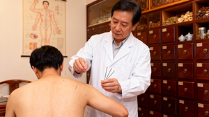 Aghi per Agopuntura Sterili Monouso con Manico in Acciaio Inossidabile Confezionati in Foglio di Alluminio - Product Image 3