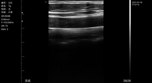 <span class=keywords><strong>Doppler</strong></span> warna 7.5-10mhz genggam nirkabel Probe Ultrasound Msk & vaskular - Product Image 5