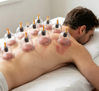 Meilleures ventes 2026 : Ventouses de Hijama Médical Chinois – Ventouses Individuelles en Plastique pour une Santé Optimale