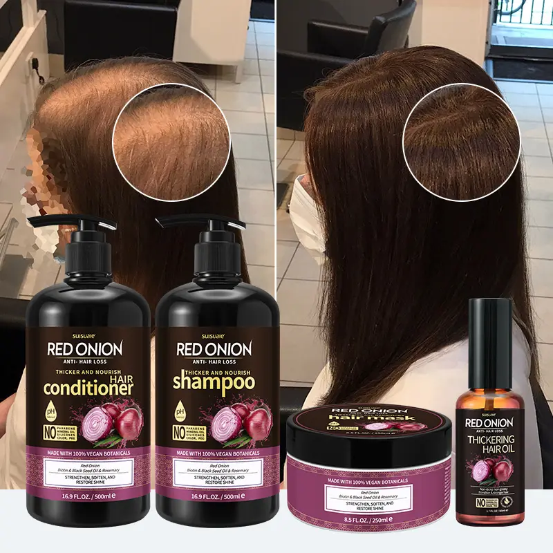 OCCA Private Label Anit-saç dökülmesi büyümeyi güçlendirir saç kırmızı soğan yeniden büyüme saç şampuan ve saç kremi Set