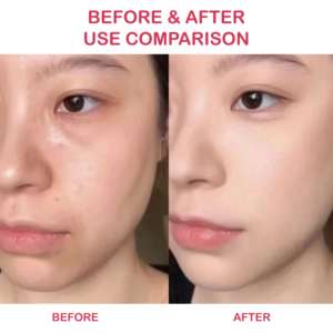 เซรั่มแอมพูลเปปไทด์ B-Tox ระดับมืออาชีพ สำหรับผิวกระชับและลดเลือนริ้วรอย ให้ผลลัพธ์เหมือนโบท็อกซ์  ทรีทเมนต์ต่อต้านริ้วรอยสำหรับร้านเสริมสวย - Product Image 4