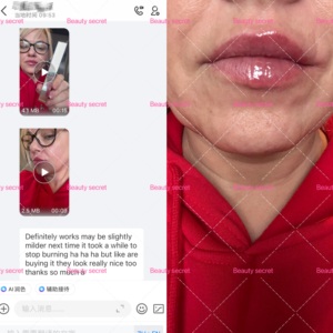 Huile Repulpante Lèvres Effet Picotant Instant Gloss Extrême Stylo Repulpant Lèvres au Collagène, Squalane et FPS 20 - Product Image 5