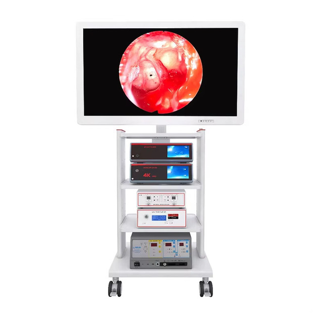 Hot Selling UHD Ultra HD Endoscopy Camera System Medical Endoscope Camera for Laparoscopy Surgery