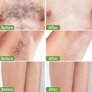 Sumax 60 Count Body Bikini Cold Wax <span class=keywords><strong>strisce</strong></span> di depilazione includono 40 9*18 cm <span class=keywords><strong>strisce</strong></span> per il corpo e 20 piccole <span class=keywords><strong>strisce</strong></span> per il viso - Product Image 5