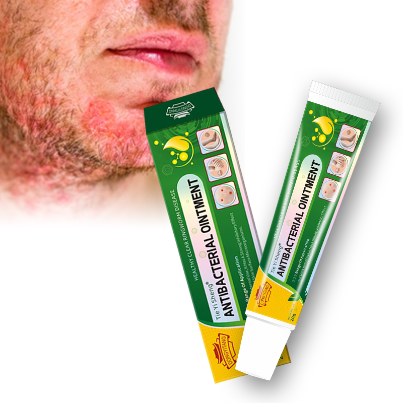 High Quality Skin Itching Ointment Fungal Infection Eczema Cream Herbal Green Healthy Skin Care Cream