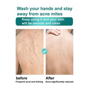 Roushun 1000ml Đu Đủ có mùi thơm Nano tẩy tế bào chết làm sạch sâu công thức loại bỏ mụn trứng cá ve chà Gel tắm cho cơ thể mịn màng - Product Image 5