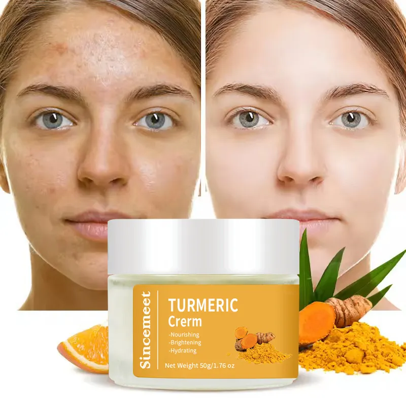 Creme facial de marca própria, clareador e hidratante sem sulfato, 100% orgânico, vitamina C, cúrcuma, creme facial para remoção de espinhas e acne