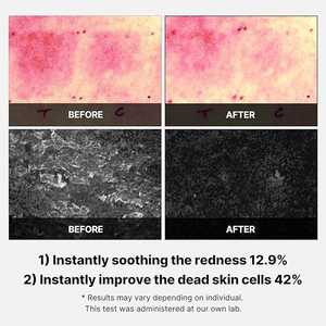 Almohadillas de Tónico Super Cica MEDICUBE, 70 unidades/350 g, Almohadillas de Tónico Blanqueadoras para el Cuidado de la Piel con Ácido Hialurónico y Colágeno para el Cuidado Diario del Rostro - Product Image 4