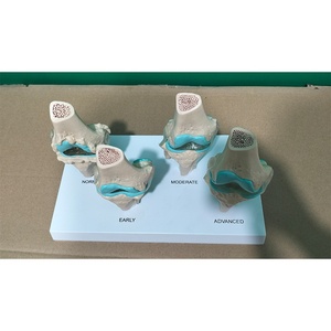 Material Didáctico Médico: Comparación de Patrones Normales y Patológicos para la Comunicación Médico-Paciente, Anatomía de la Articulación del Rodilla Humana - Product Image 4