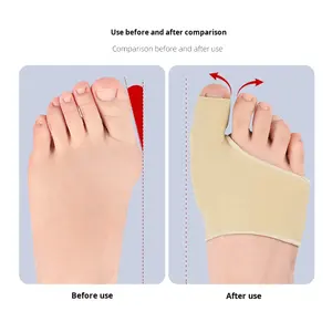Corrector de Hallux Valgus para el Dedo Gordo del Pie, Protector de Juanetes, Funda de Hueso, Transpirable, Acolchado, Suave, Lycra+SEBS, Unisex - Product Image 2