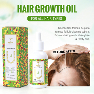 Aceite Herbal para el Crecimiento del Cabello con Cebolla y Romero, Marca Privada OEM, para Cabello Rizado y Fino, Fórmula 2 en <span class=keywords><strong>1</strong></span> Sin Silicona - Product Image 4