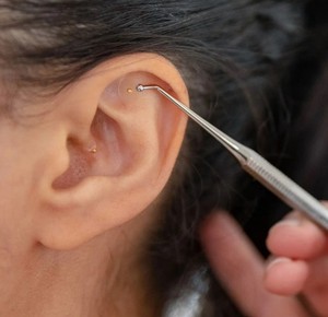 Bulut ejderha 24K altın kulak tohumları Auricular nokta etiket kulak akupunktur noktası terapi Earseeds ile şeffaf bant - Product Image 4