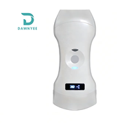 Sonde d'échographie portable sans fil 192 éléments, Doppler couleur, Sonostar, sonde d'échographie sans fil 3 en 1