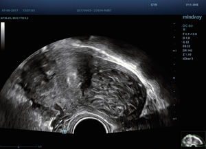 Système d'échographie couleur Doppler intelligent Mindray DC-80S pour vétérinaire et pédiatrie, avec sondes, pour une imagerie haute résolution - Product Image 6