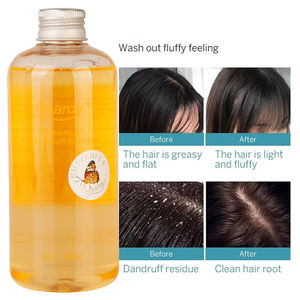 <span class=keywords><strong>Champú</strong></span> Anticaspa con Aminoácidos Haardy para Hombres y Mujeres, para Cuero Cabelludo Escamoso, con Picazón, Graso y Seco - Nutre el Cuero Cabelludo y Reduce las Escamas - Product Image 2