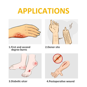 Hàng tiêu dùng y tế mật ong canxi alginate mặc quần áo Manuka mật ong vết thương mặc quần áo - Product Image 6