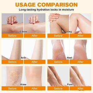 Baume fouetté au suif de bœuf nourri à l'herbe et au miel sauvage, non parfumé, naturel, pour tous types de peau (visage et corps) - Product Image 6