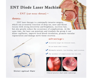 1470nm/980nm Multifunktionales Diodenlaser-Gerät zur Gefäßentfernung, Nagelpilzbehandlung, Körper- und Gesichtsstraffung, Tragbares Plastikchirurgie-Gerät - Product Image 4
