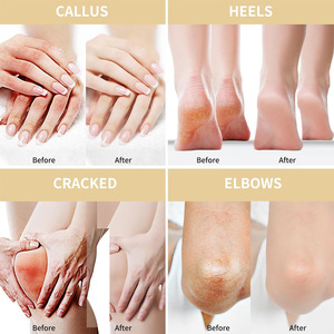 Crème Réparatrice OEM Personnalisée à 50% d'Avoine et d'Urée, Acide Salicylique et Arbre à Thé pour Mains et Pieds Secs et Fissurés, Nourrissante - Product Image 2