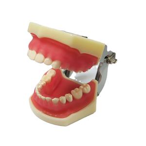 Modelo de Enfermedades gingivales Modelo de dientes de enfermedad de encías dentales - Product Image 1