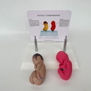 Comparaison des sciences médicales Modèle de maladie de pathologie de malformation fœtale humaine Modèle de maladie d'organe Modèle anti-drogue - Product Image 3