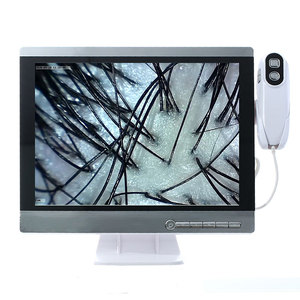 SkySpirit profissional Hd cabelo folículos couro cabeludo scanner detector cabelo analisador/pele e máquina análise cabelo couro cabeludo - Product Image 3