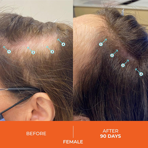 Champú para el crecimiento y engrosamiento del cabello con cafeína y biotina orgánica natural <span class=keywords><strong>de</strong></span> alto rendimiento para el crecimiento del cabello, champú espesante <span class=keywords><strong>de</strong></span> densidad - Product Image 6