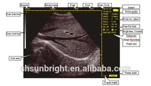 Sunbright SUN-808F Ultrasound Portabel untuk Dokter Hewan, Pemindai Ultrasound Portabel