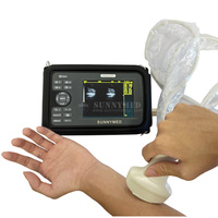 Scanner à ultrasons sans fil portatif vétérinaire Scanner de grossesse animal numérique avec sonde convexe ou sonde rectale
