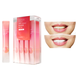 Los más vendidos de Amazon Paquetes de <span class=keywords><strong>enjuague</strong></span> <span class=keywords><strong>bucal</strong></span> desechables de menta fresca sin alcohol y fluoruro Tiras de <span class=keywords><strong>enjuague</strong></span> <span class=keywords><strong>bucal</strong></span> para una higiene <span class=keywords><strong>bucal</strong></span> superior - Product Image 3