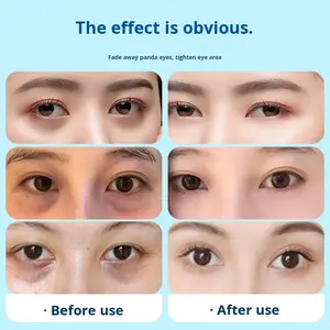 Mascarilla de Ojos de Silicona <span class=keywords><strong>con</strong></span> <span class=keywords><strong>Purpurina</strong></span> Dorada Hidratante, <span class=keywords><strong>con</strong></span> Colágeno y Aloe Vera, Reduce las Líneas Finas, Alivia la Fatiga, para Todo Tipo de Piel - Product Image 4