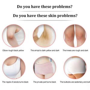 Crème éclaircissante pour les aisselles, les jambes, les genoux et la peau du corps, bio, avec logo personnalisé OEM - Product Image 2