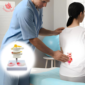 Modelo patológico de columna lumbar FRT038: Modelo humano de dos vértebras lumbares y dos discos intervertebrales enfermos con lesiones lumbares - Product Image 3