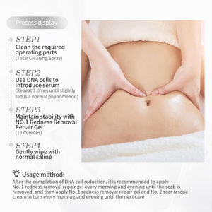 Crème Douce Non Irritante à la Rose pour Éliminer les Vergetures PDRN, Anti-rides, Anti-âge, Réparation Cutanée Post-Grossesse, Élimine les Cicatrices de Grossesse - Product Image 5