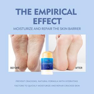 Crema de Masaje Facial Vegana a Base de Hierbas de Rosa con Vitamina C y E, Hidratante, Antienvejecimiento, Blanqueadora, Elimina la Piel Muerta - Product Image 6