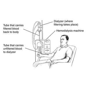 Yüksek hızlı hassas hemodiyaliz kan boru boru yapma makinesi - Product Image 2