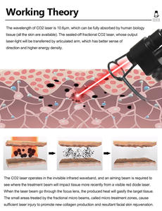 Machine à laser fractionné CO2 haute puissance, bras articulé en acier inoxydable à 7 articulations, écran tactile de 12,1 pouces pour le rajeunissement de la peau et le traitement de l'acné - Product Image 4