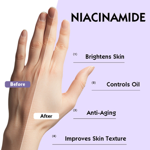 Oem masker tangan hidrasi Anti Penuaan, perawatan Spa intensif tangan kering meningkatkan tekstur kulit kecantikan Niacinamide sarung tangan - Product Image 3